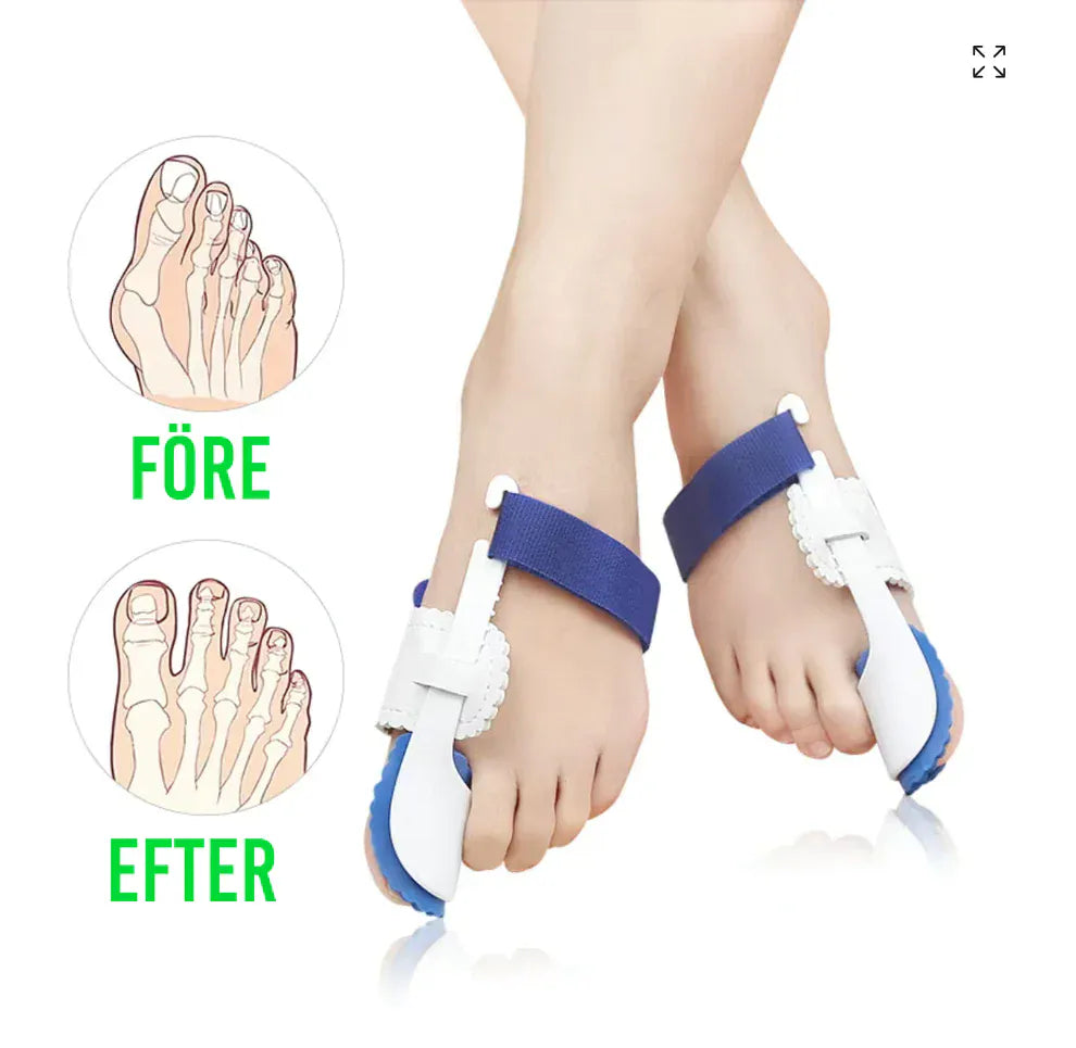 Hallux Valgus bundle