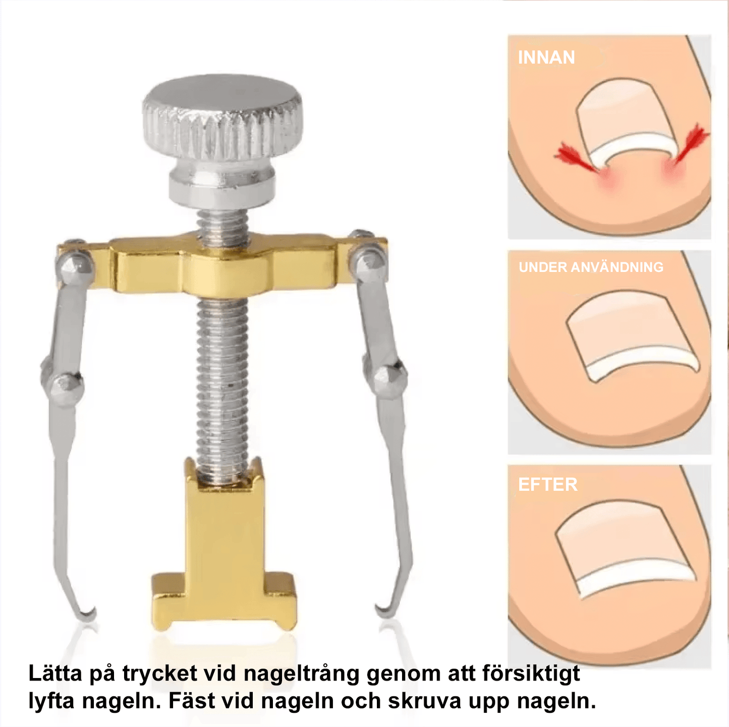 Verktyg mot nageltrång